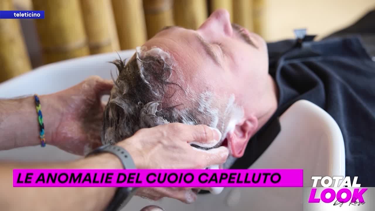 Total Look by Rosi del 9 dicembre 2025 - LE ANOMALIE DEL CUOIO CAPELLUTO