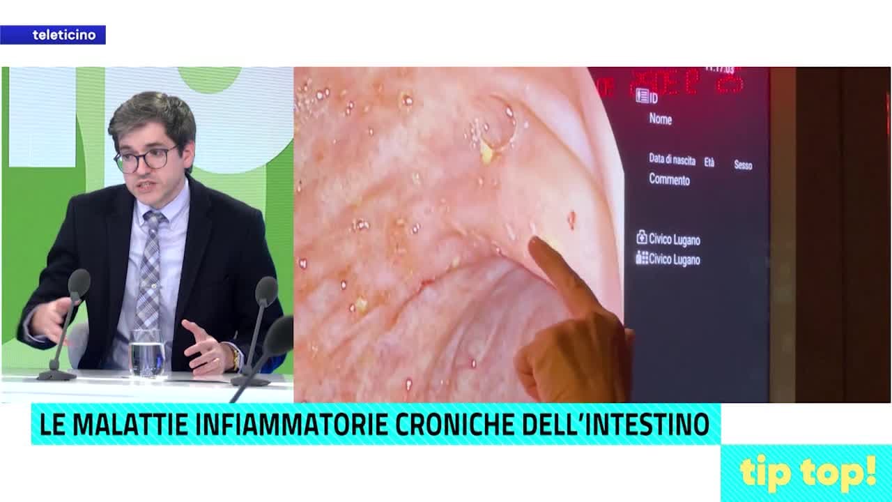 Tip Top Pronto Dottore del 11 novembre 2025 - LE MALATTIE INFIAMMATORIE CRONICHI DELL'INTESTINO